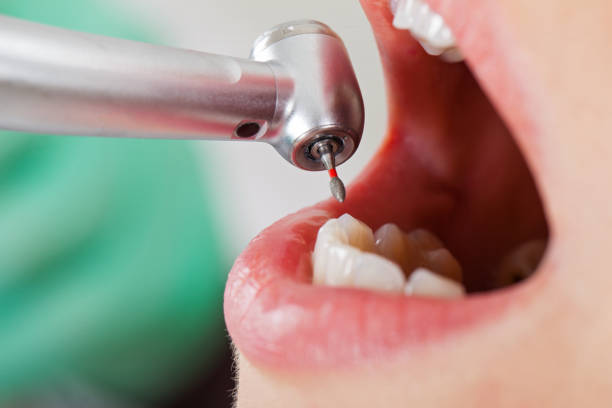 Best Weekend Emergency Dental Services in Colona, IL